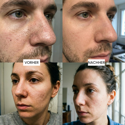 Alpine Weiss-Peeling Duo